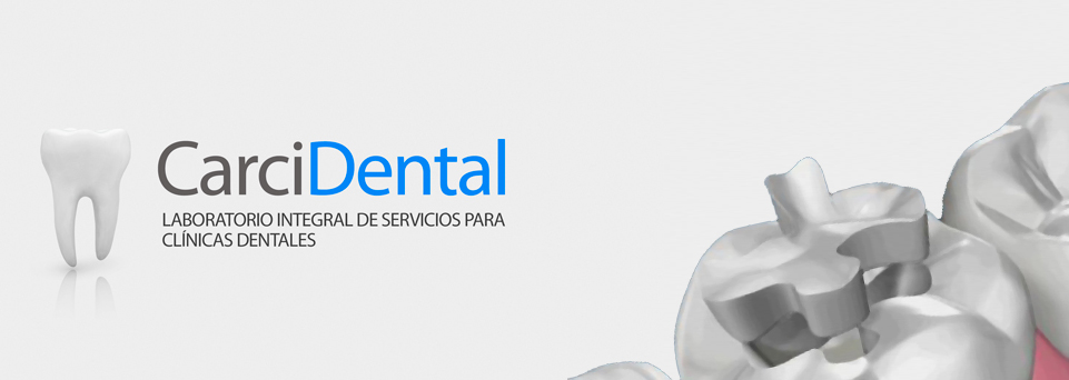 carcidental-incrustaciones dentales